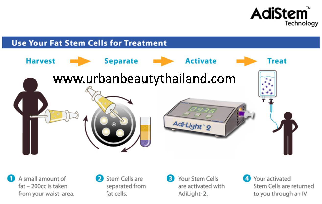 adistem-stem-cell-bangkok-phuket-thailand