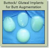 buttock-implant-thailand-bangkok-butt-lift-butt-reduction-butt-lift-thailand