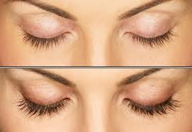 Eyelash Transplant and Implant Procedure